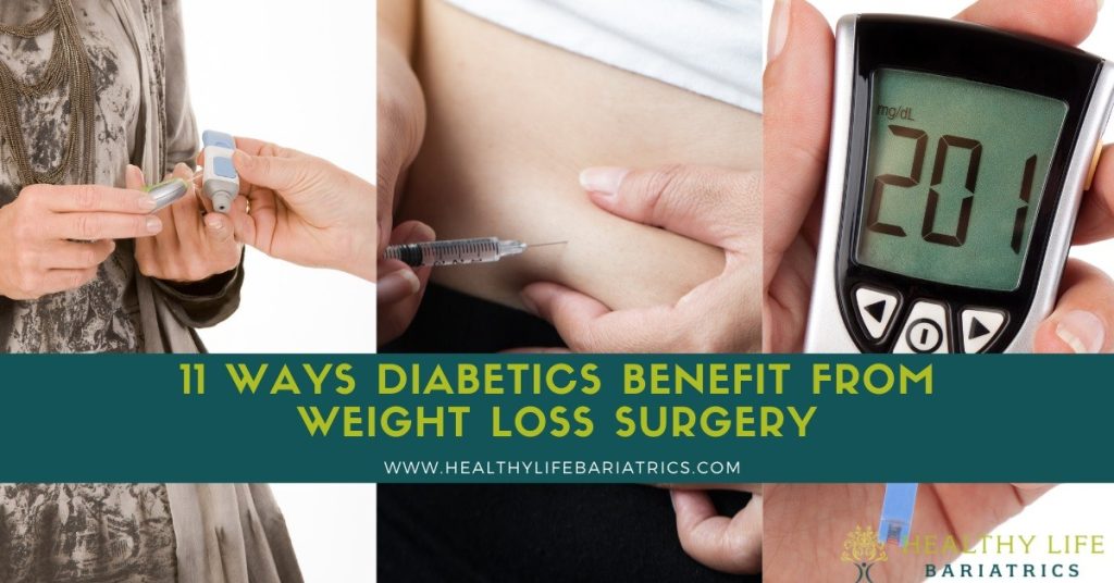 11 Ways Diabetics Benefit from Weight Loss Surgery
