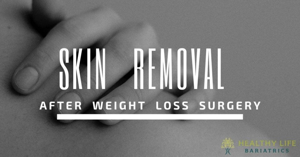 Skin Removal After Weight Loss Surgery – What You Should Know