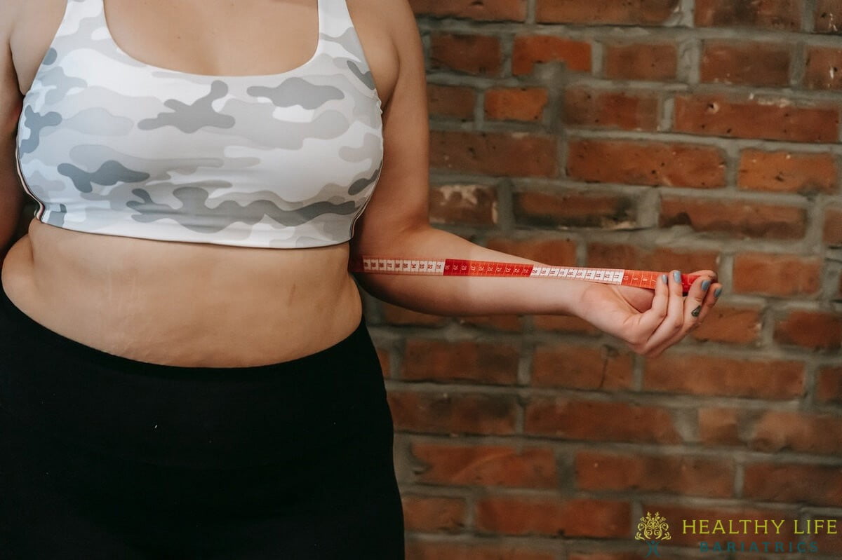 Conventional Weight Loss Methods