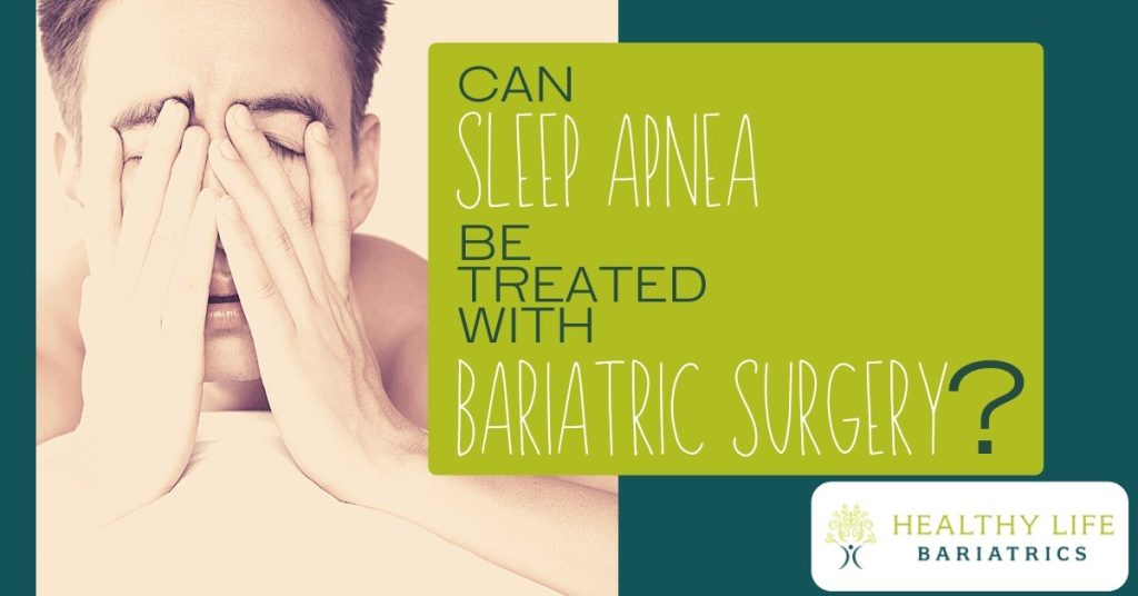 Can Sleep Apnea be Treated with Bariatric Surgery?