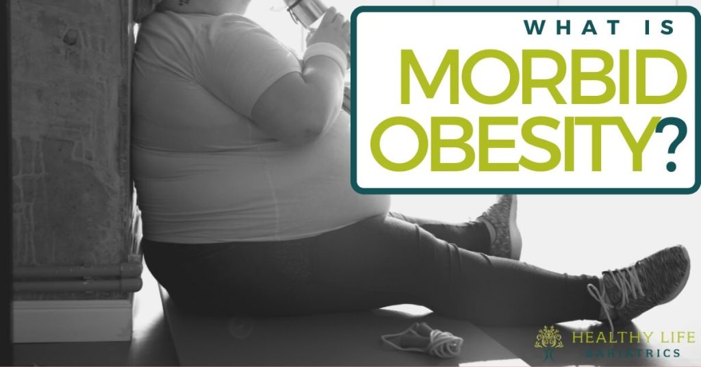 What is Morbid Obesity & How Does it Affect You?