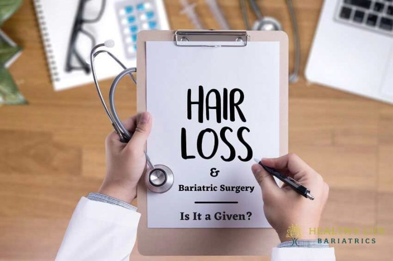Hair Loss and Bariatric Surgery 5 Important Facts, Los Angeles