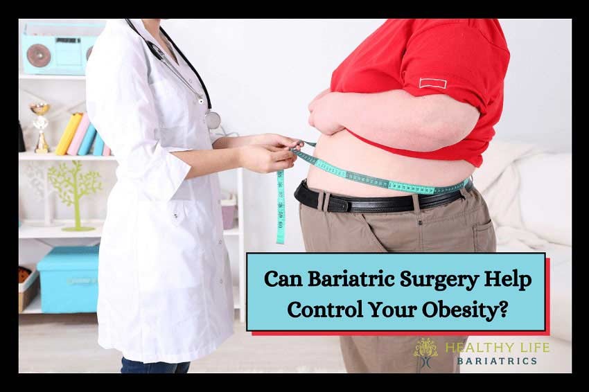 Obesity Control with Bariatric Surgery
