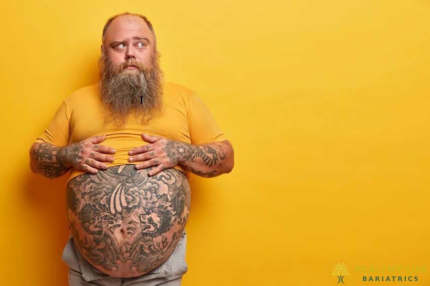 Weight Loss Surgery
