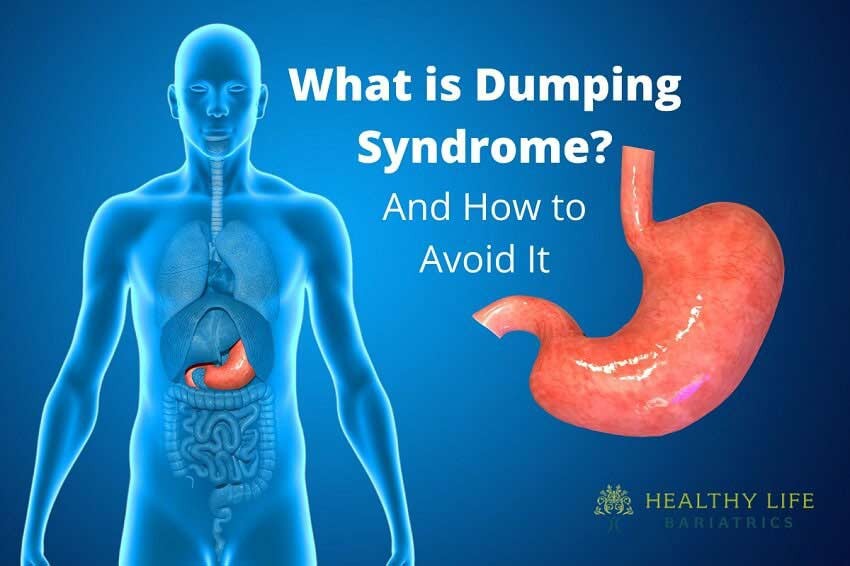 How To Avoid Dumping Syndrome In Los Angeles CA HLB