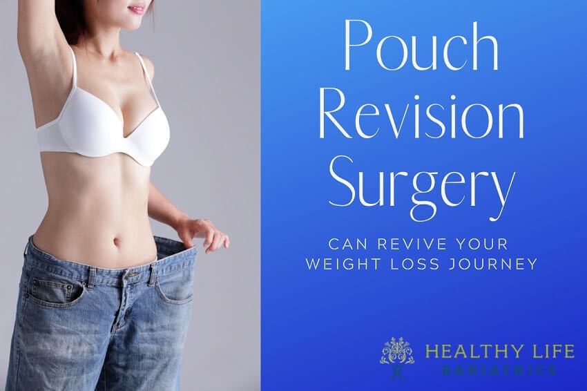  Pouch Revision Surgery in Los Angeles, CA