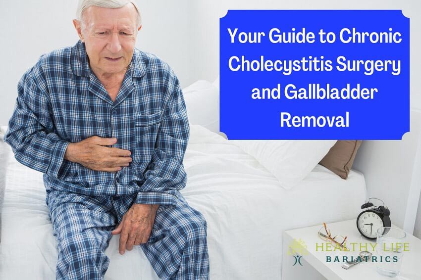 Chronic Cholecystitis Surgery and Gallbladder Removal – The Complete Guide