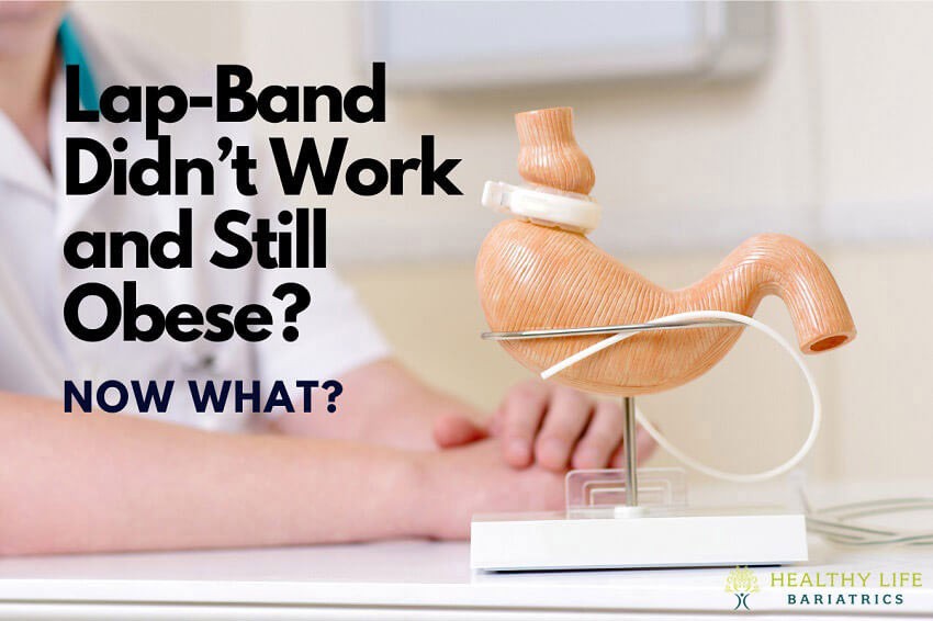 Lap-Band Didn’t Work and Still Obese? Now What?