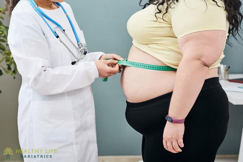 Best Candidate for Bariatric Surgery in Los Angeles CA