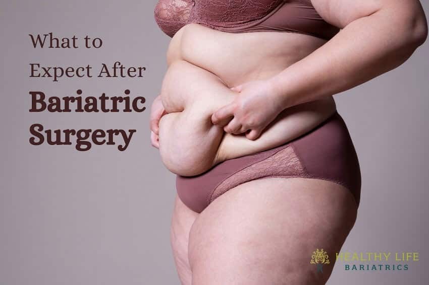 What Can You Expect After Bariatric Surgery in Los Angeles, CA?
